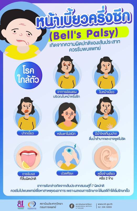 กรมการแพทย์ โดยสถาบันประสาทวิทยา เตือนอาการอ่อนแรง บริเวณใบหน้าครึ่งซีก ใบหน้าเบี้ยว หลับตาไม่สนิท ปากเบี้ยว มีน้ำไหลที่มุมปาก และอาจพูดไม่ชัด การรับรสที่ลิ้นผิดปกติ ปวดศีรษะ หูอื้อข้างเดียวหรือ 2 ข้าง ดื่มน้ำลำบากพูดไม่ชัด เกิดจากเส้นประสาทสมองคู่ที่ 7 ผิดปกติ